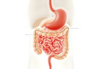gangguan-sistem-pencernaan gangguan sistem pencernaan