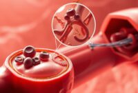 mekanisme pembekuan darah