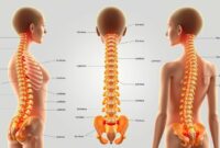 kelainan tulang belakang