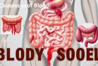 penyebab bab berdarah